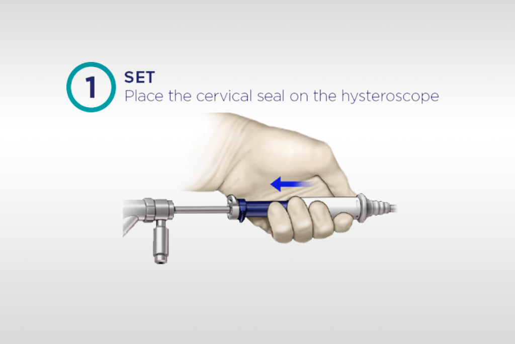 Image of hand holding Omnilock