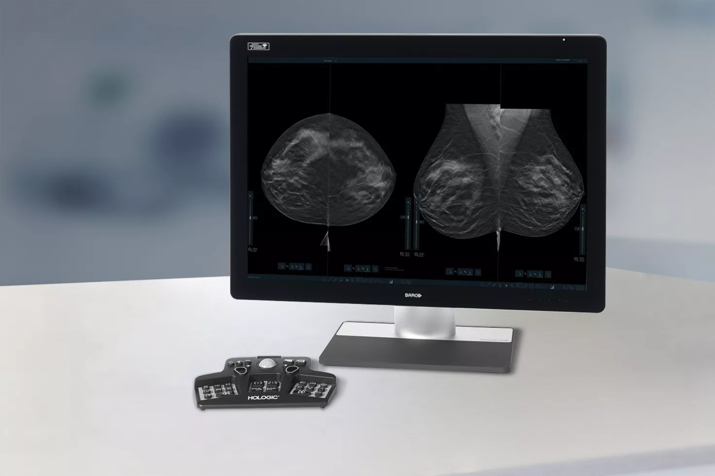 imaging of breast on computer screen