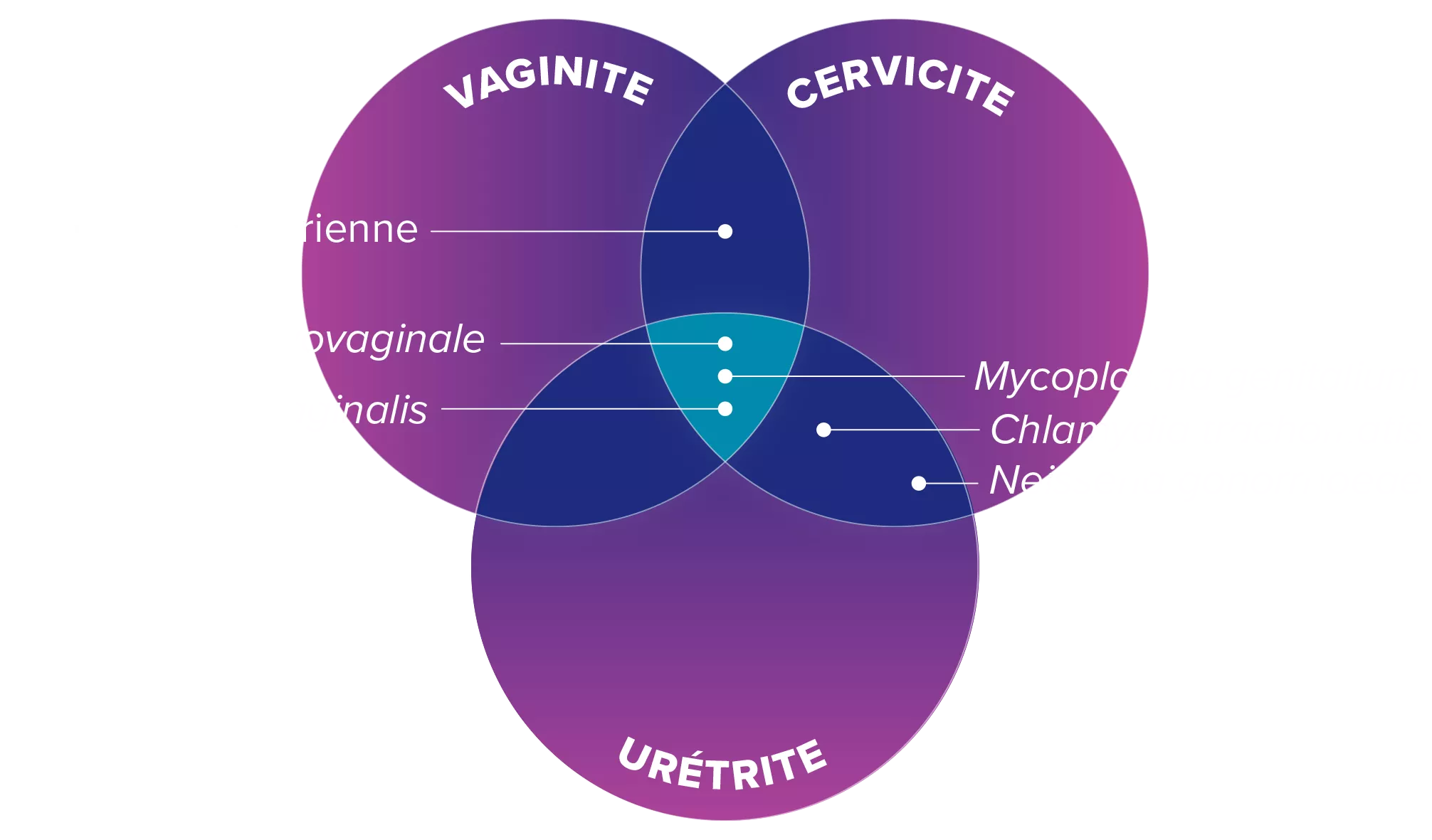Illustration superposée de la vaginite, de la cervicite et de l’urétrite