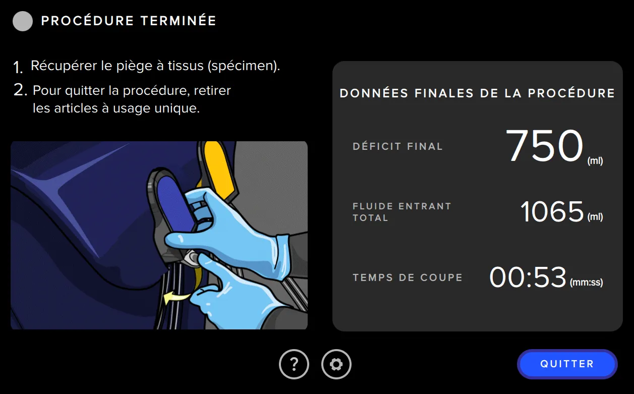Capture d’écran de l’interface utilisateur du système de gestion des fluides Fluent Pro montrant le résumé de la procédure.